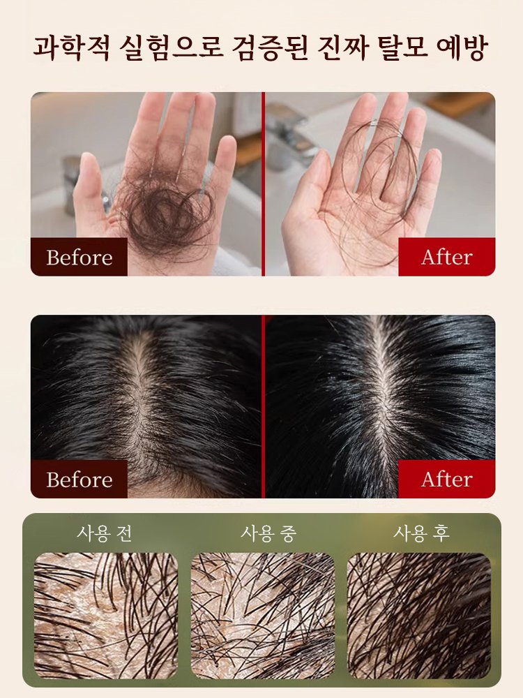 【1번 세척으로 헤어 양 두배 증가】탈모 예방 샴푸