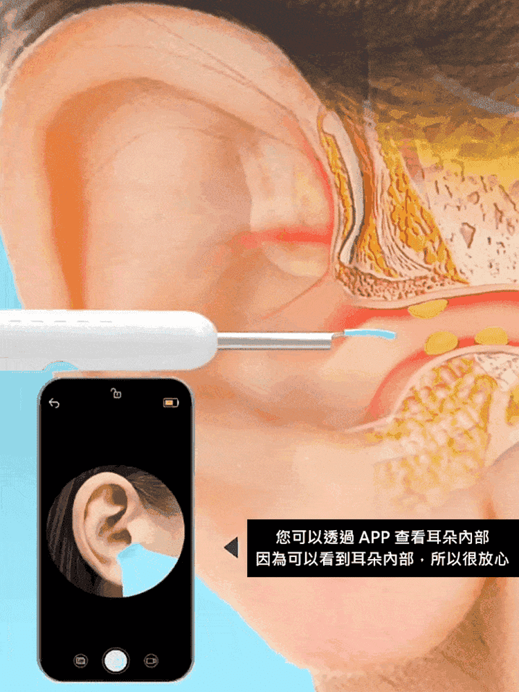 高清可視挖耳勺套裝