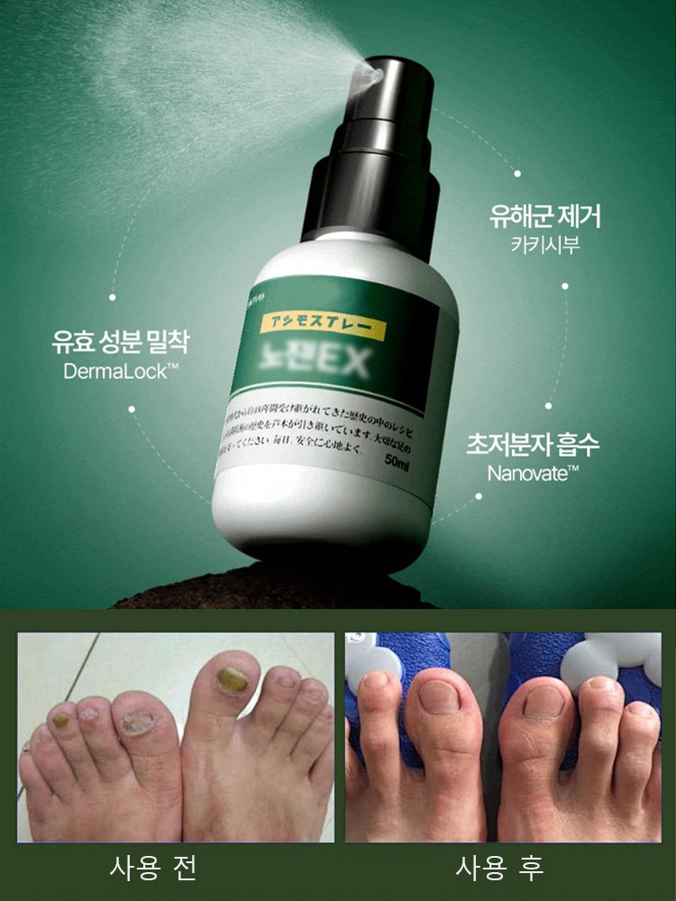 【3일 간지러움 완화】항균 발냄새 케어 스프레이