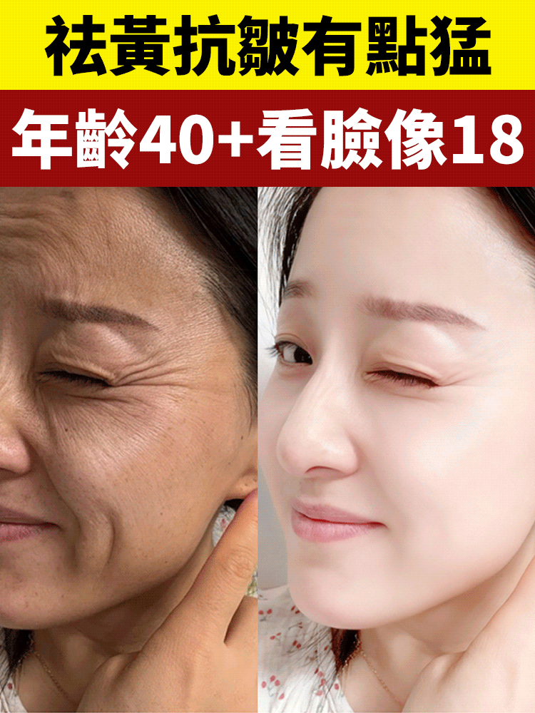 黃耆多肽抗皺緊緻乳霜