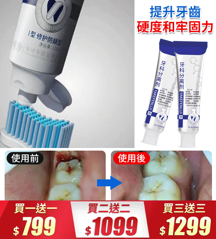 【改善牙齦腫痛、敏感、出血、牙齒鬆動問題】牙齒分離劑牙膏