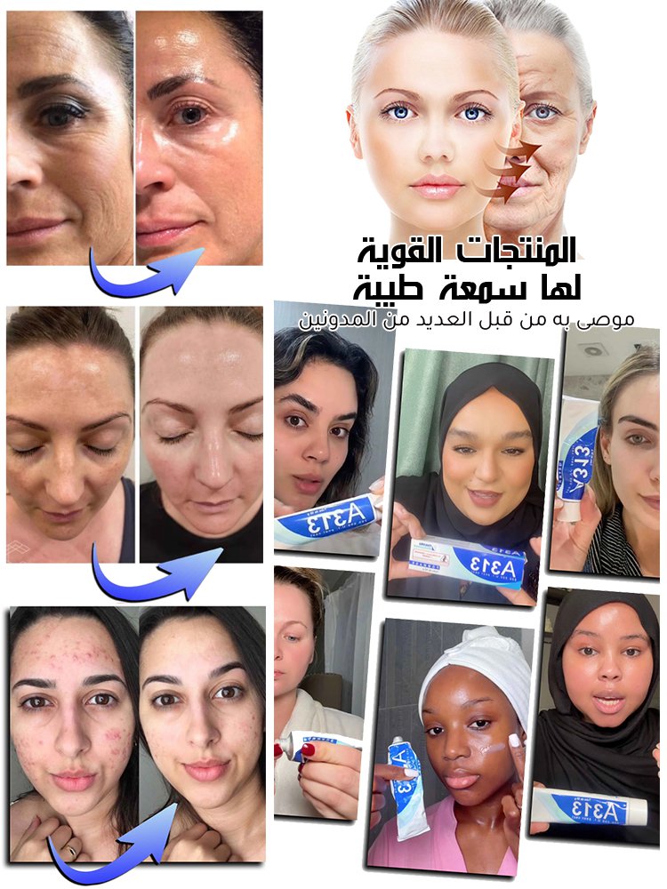 【موصى به بشدة من المدونين】كريم A313 بالريتينول لتنشيط البشرة