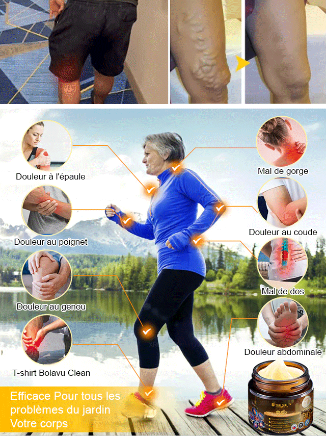 Crème analgésique et cicatrisante au venin d'abeille