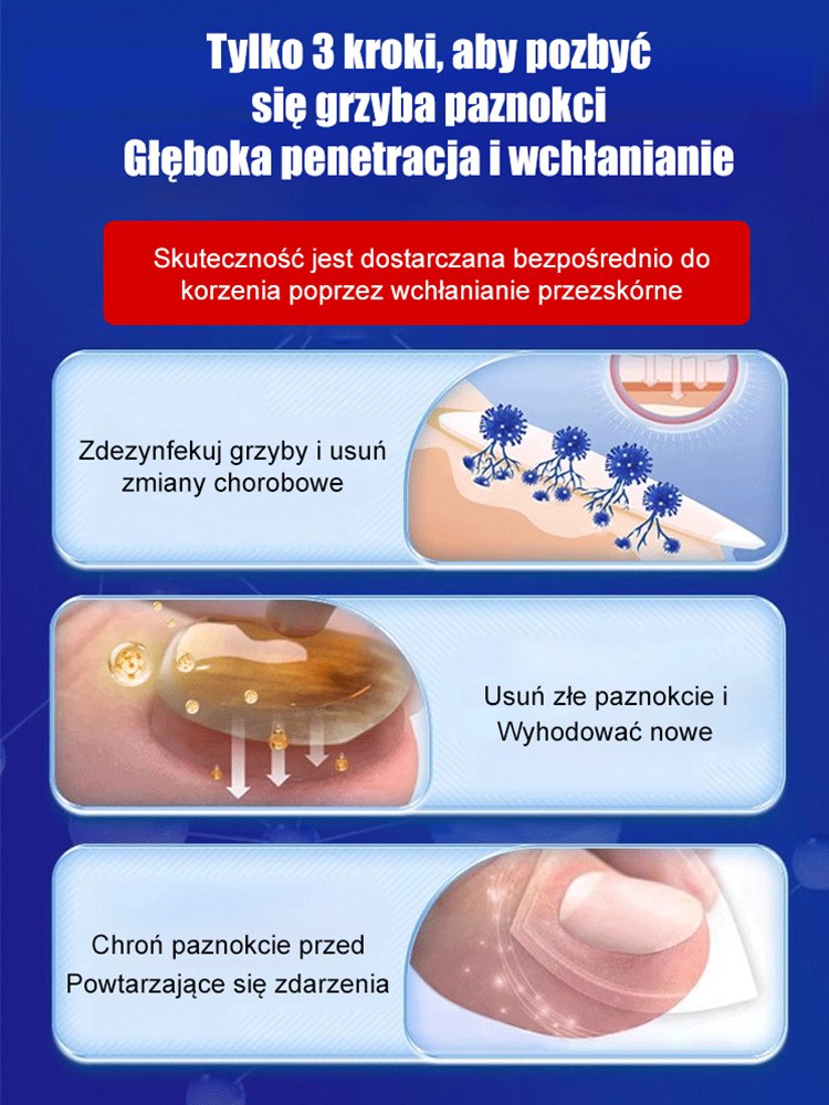 Ziołowy krem do naprawy paznokci dla paronycji