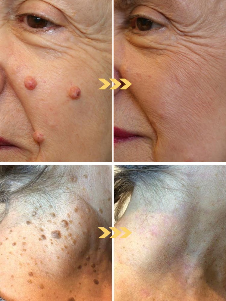 LOVILDS™ アイスクール肌修復スプレー