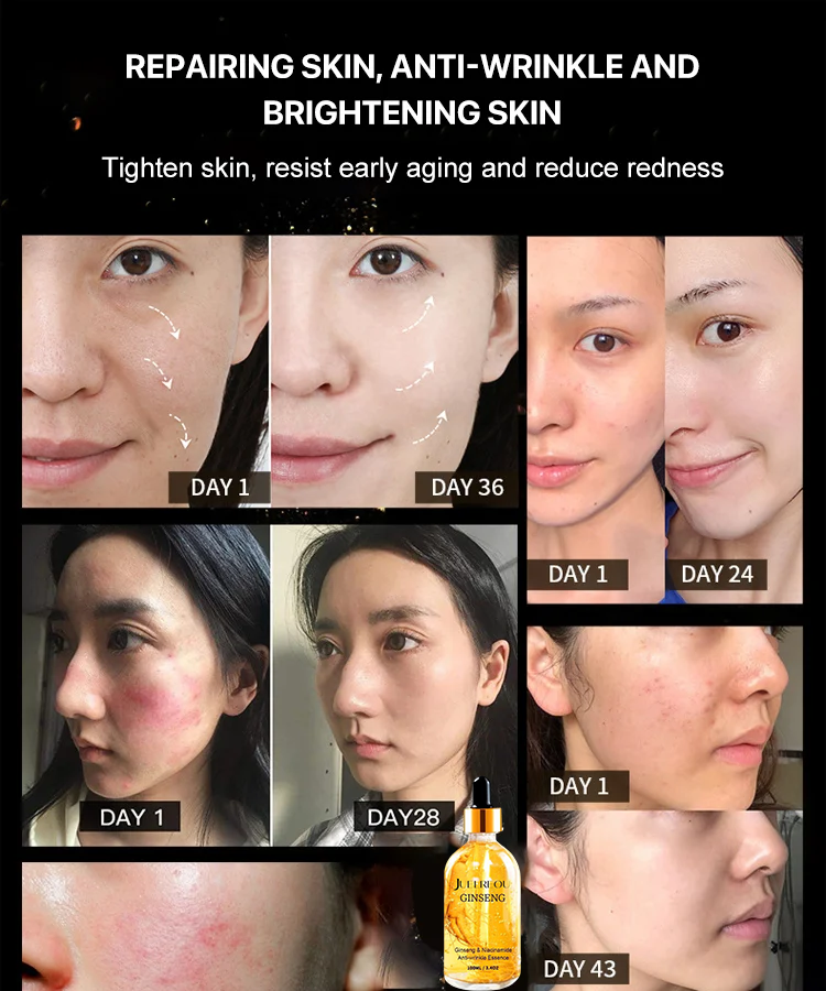 Hot sale ginseng polypeptide anti-ageing essence