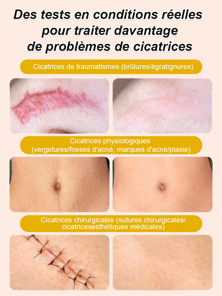 Crème lissante anti-cicatrice au venin d'abeille