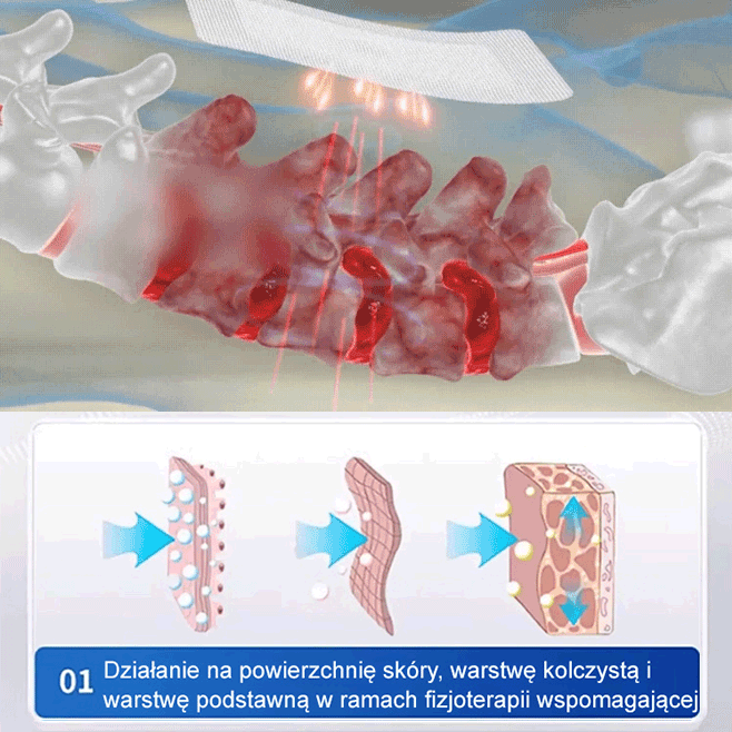 【Natychmiastowy efekt】Plaster do terapii stawów barkowych, lędźwiowych i nóg