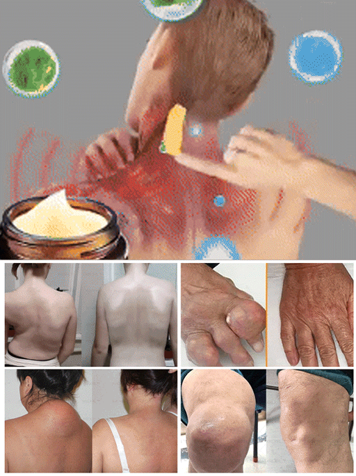 Bienengift-Schmerzstillende-Knochenheilcreme