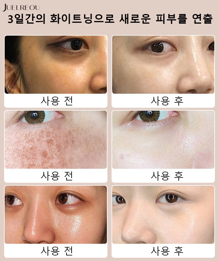 [피부 미백] 화이트닝 니코틴산 아미드 클렌징 폼