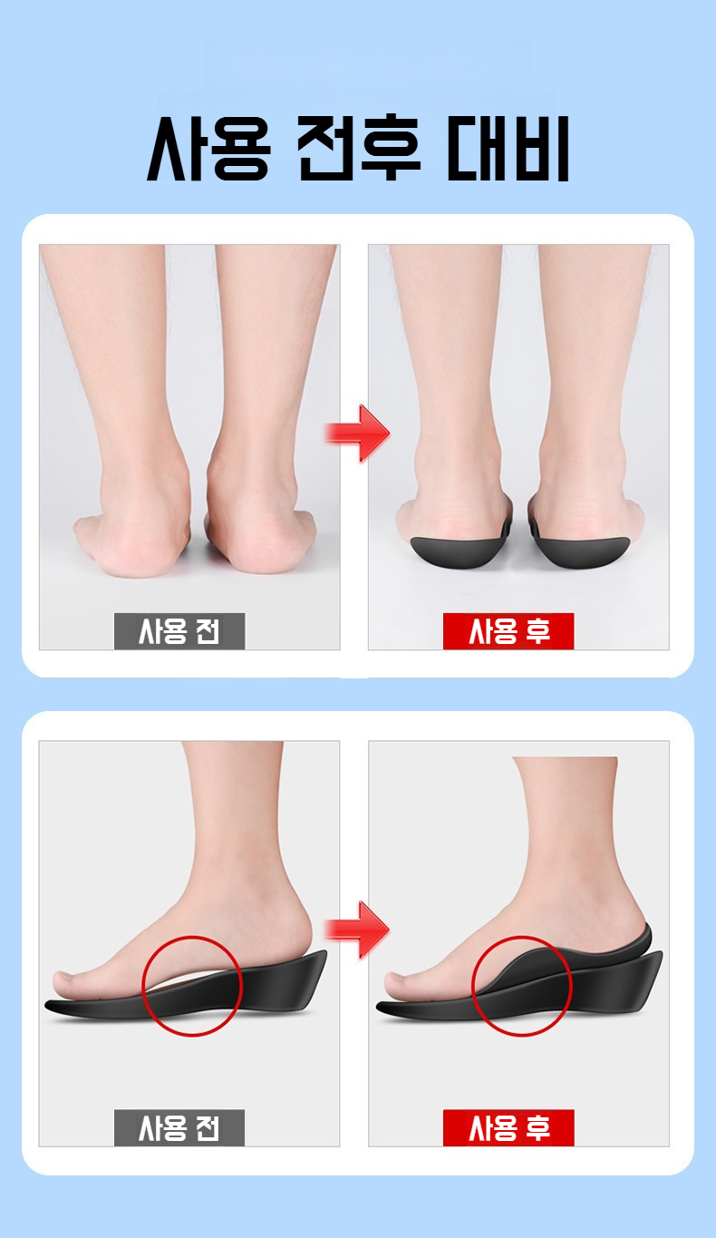 평발 교정에 도움을 주는 깔창 구조