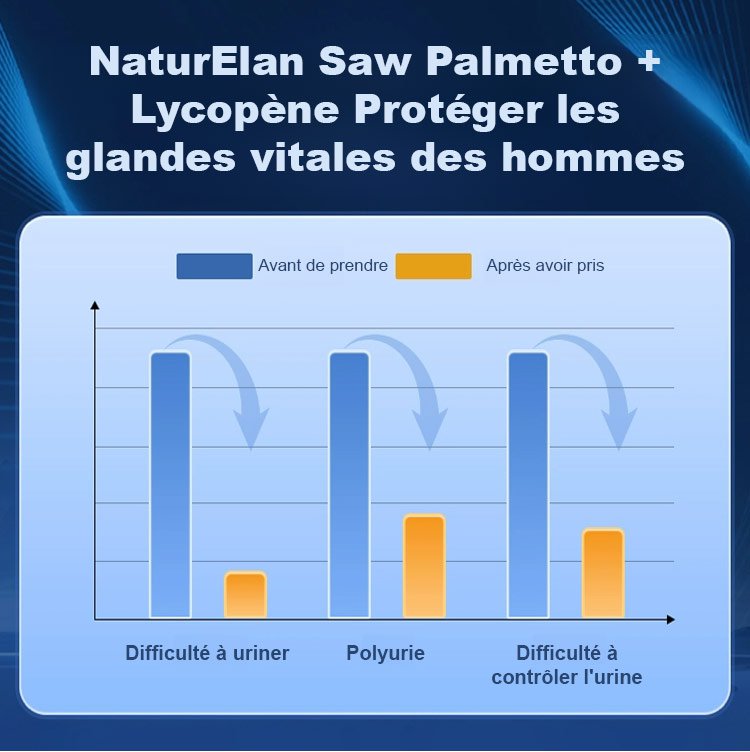 Capsule de la prostate