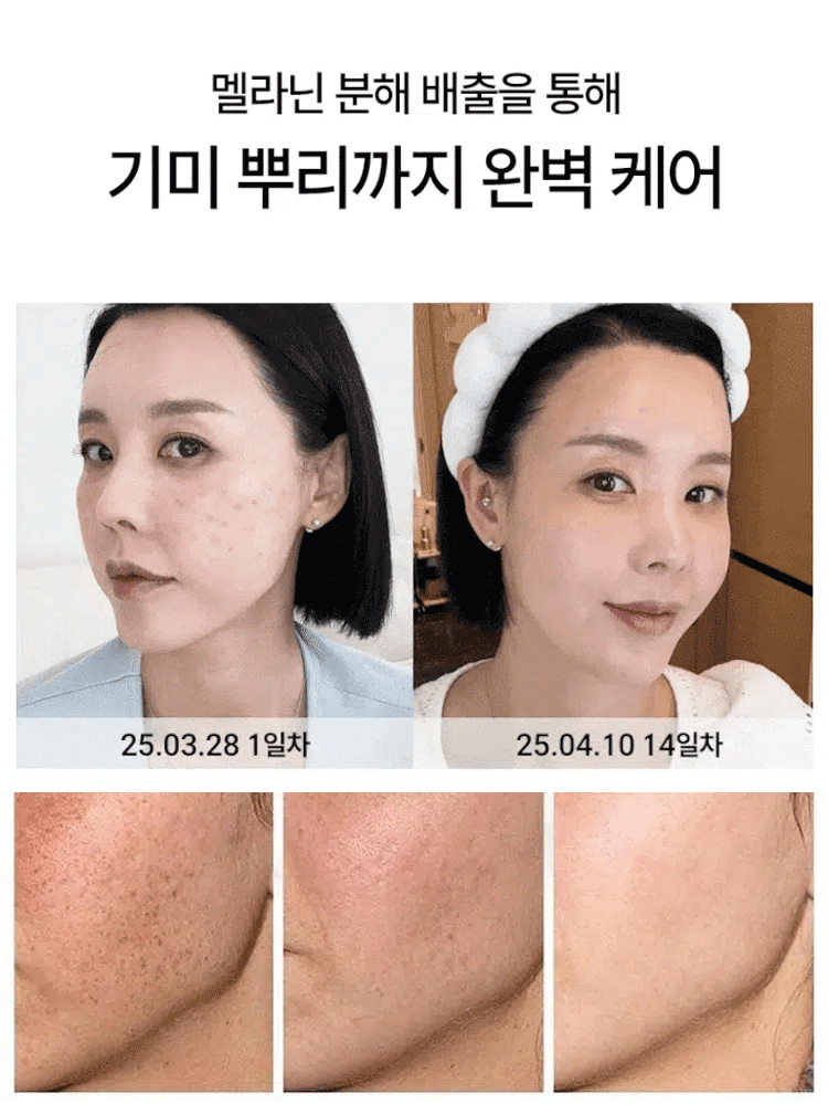 【7일 미백】전신 미백 크림