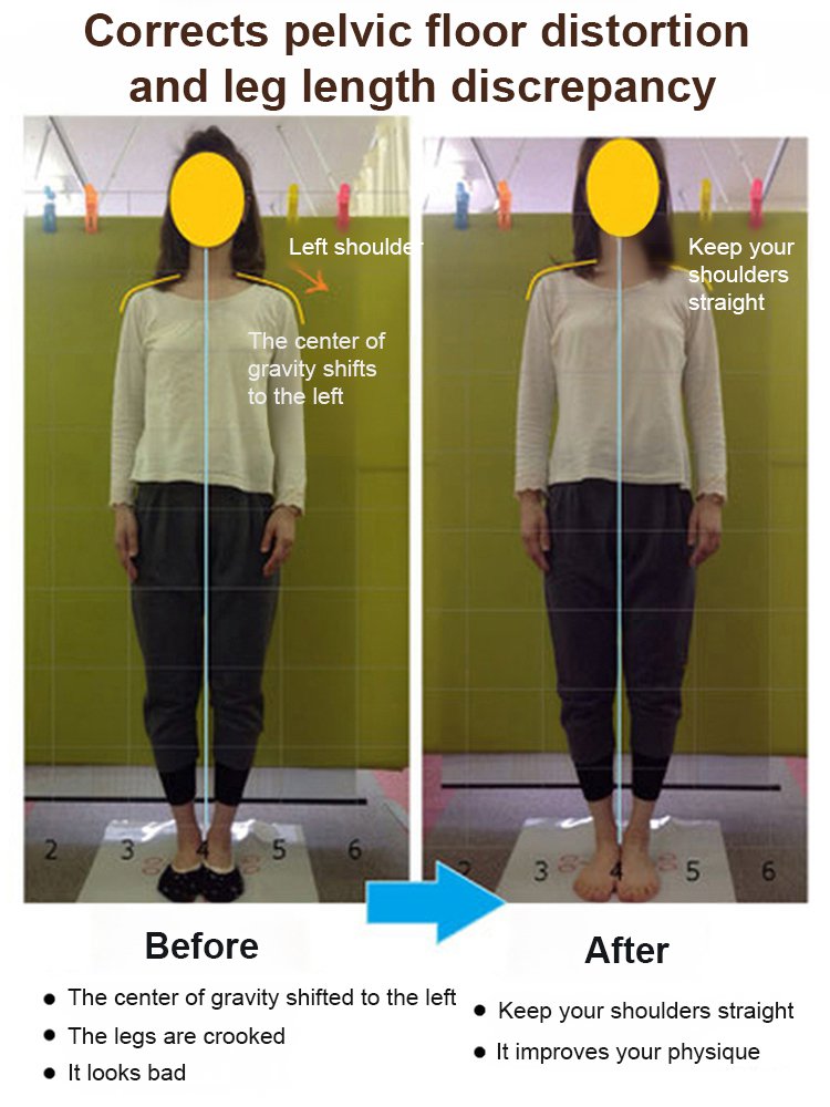 [Doctor Recommended/No Tiring of Standing for Long Periods] Triple-Proof Wide-Toe Orthotic Nursing S