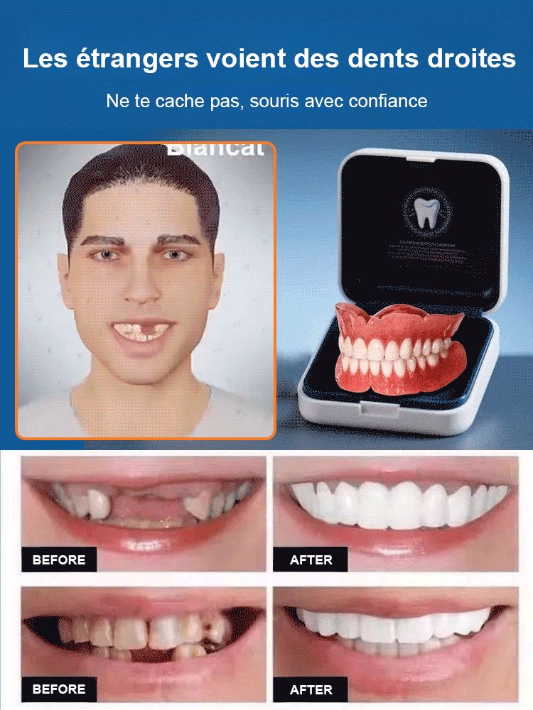 【Nouvelle découverte britannique】Appareil dentaire en silicone imitant les dents