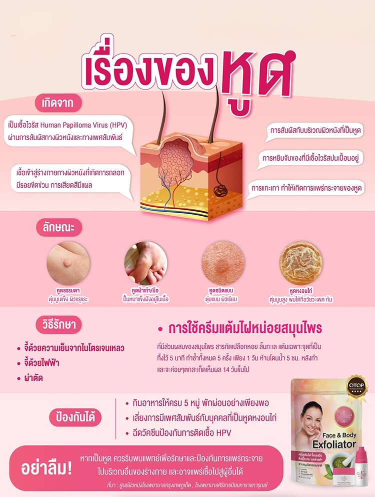 ครีมกำจัดไฝและหูดที่ดื้อรั้น