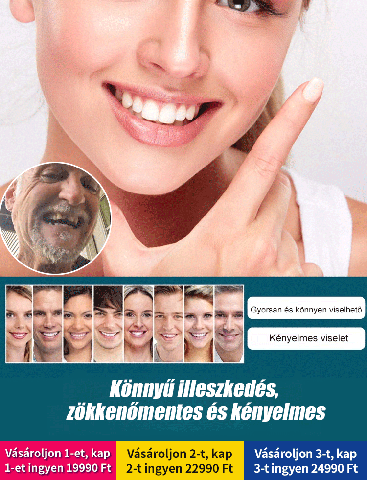 Állítható bepattintható műfogsor