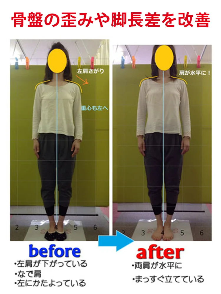 【イタリア製の本革で、通気性と滑り止め機能があり、10年間型崩れしません。】オープントゥウェッジソールサンダル