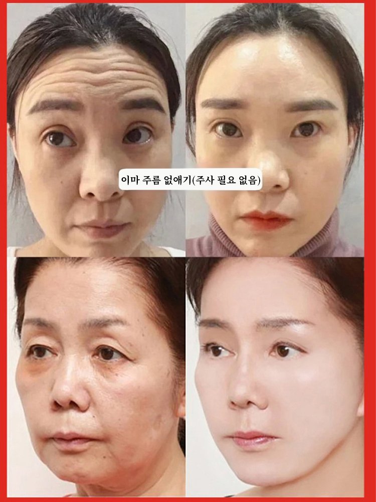 안티링클 연어 물빛 운동에너지 세포액