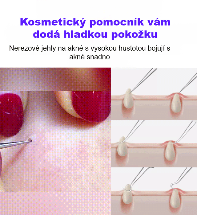 X23051506E-Vysoce přesné a vysoce tvrdé svorky článků