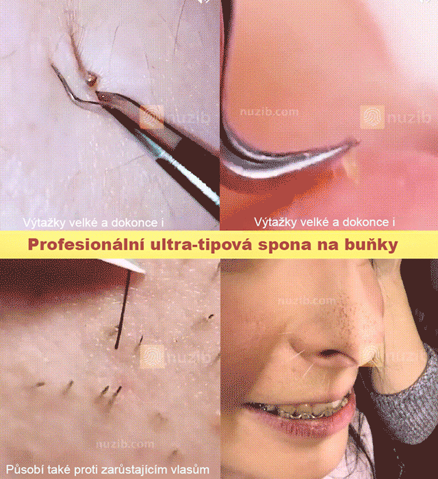 X23051506E-Vysoce přesné a vysoce tvrdé svorky článků