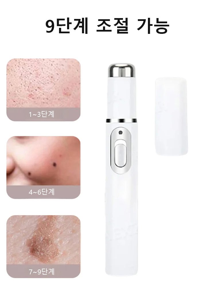 레이저 무통 사마귀 제거 펜