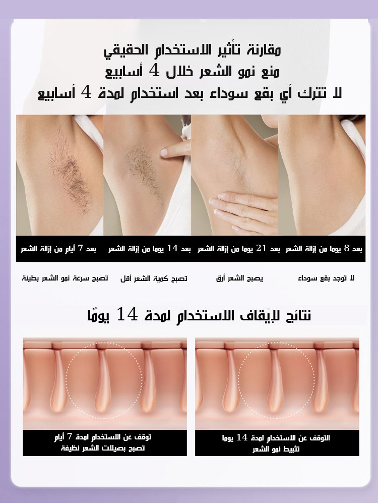  جهاز إزالة الشعر الكهربائي 