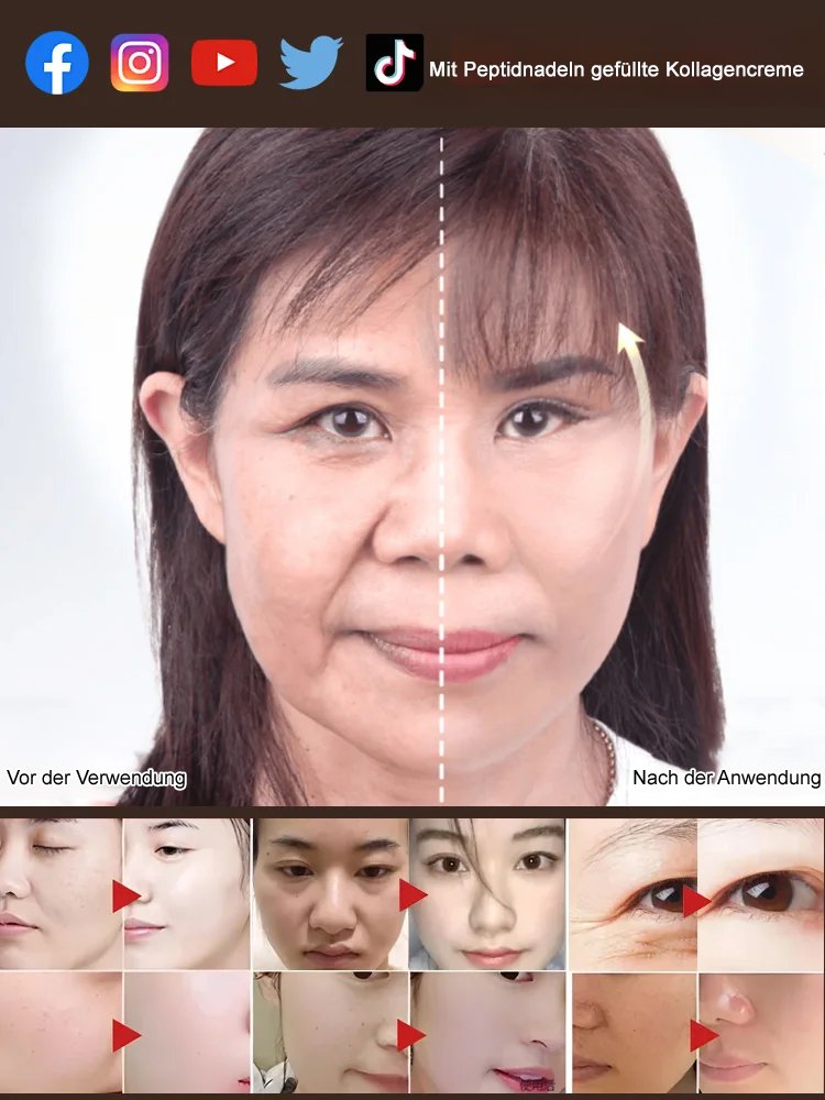 【Falten-weg Sofort】Peptid-Spritzen-Kollagen-Creme