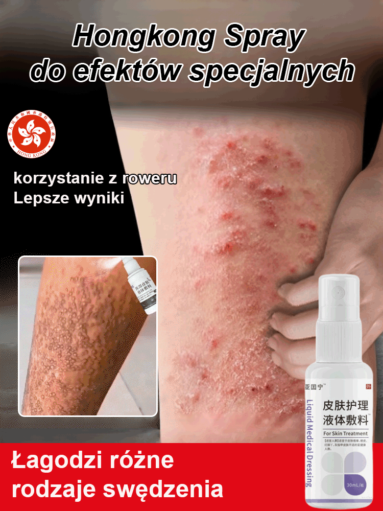 【Pogromca egzemy】Płynny opatrunek do pielęgnacji skóry