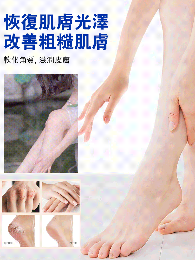 【擺脫手腳乾裂】黃耆裂可寧