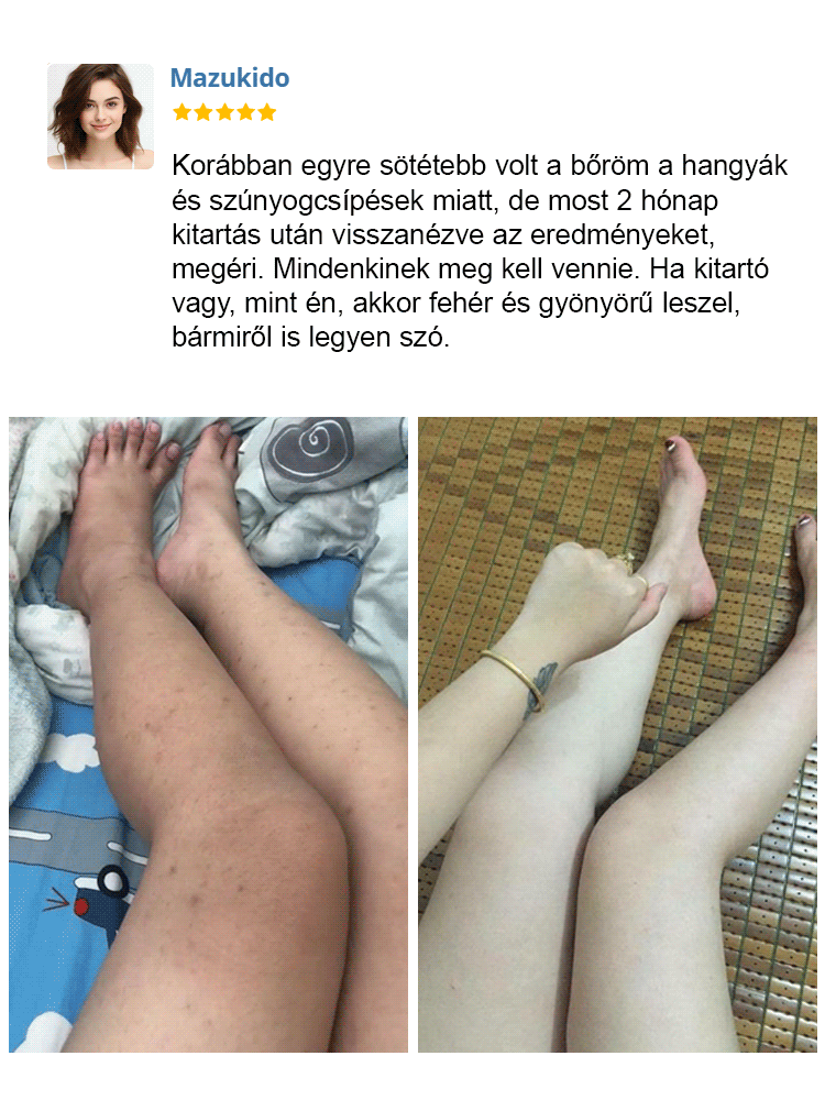 Gyógynövény kivonatokat tartalmazó ragyogást fokozó bőrradír gél