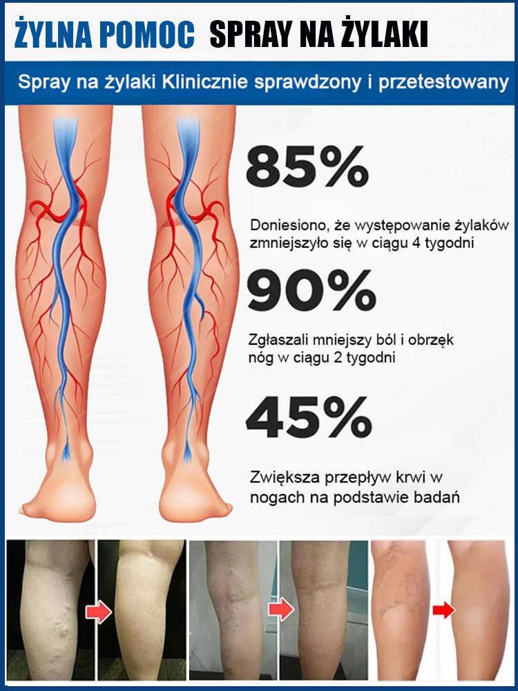 Spray do pielęgnacji żył nóg