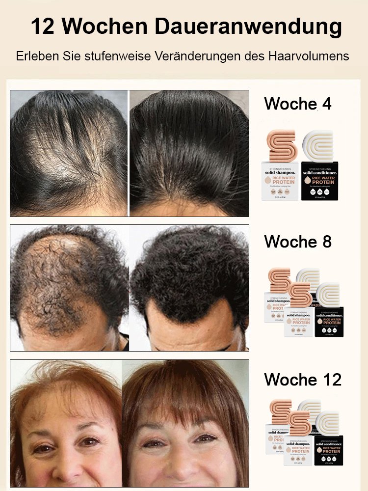 14 Tage zur Beendigung von Haarausfall】Reines natürliches Haarwuchs- und Pflegeöl-Seife