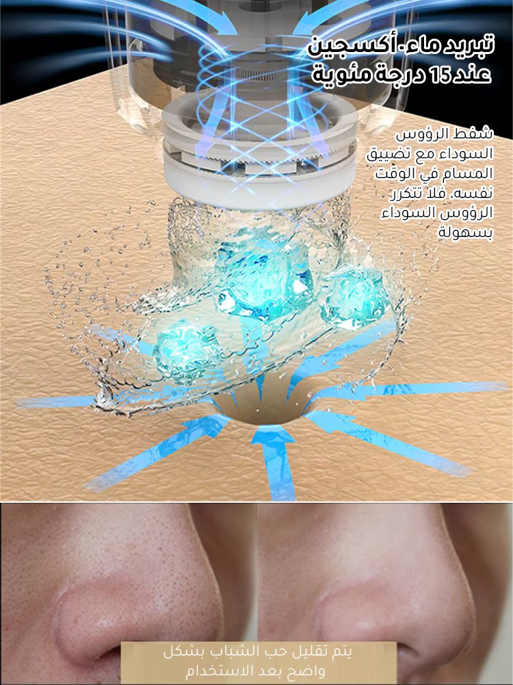 جهاز تجميل كهربائي لشفط الرؤوس السوداء (الحفاظ على نظافة البشرة)
