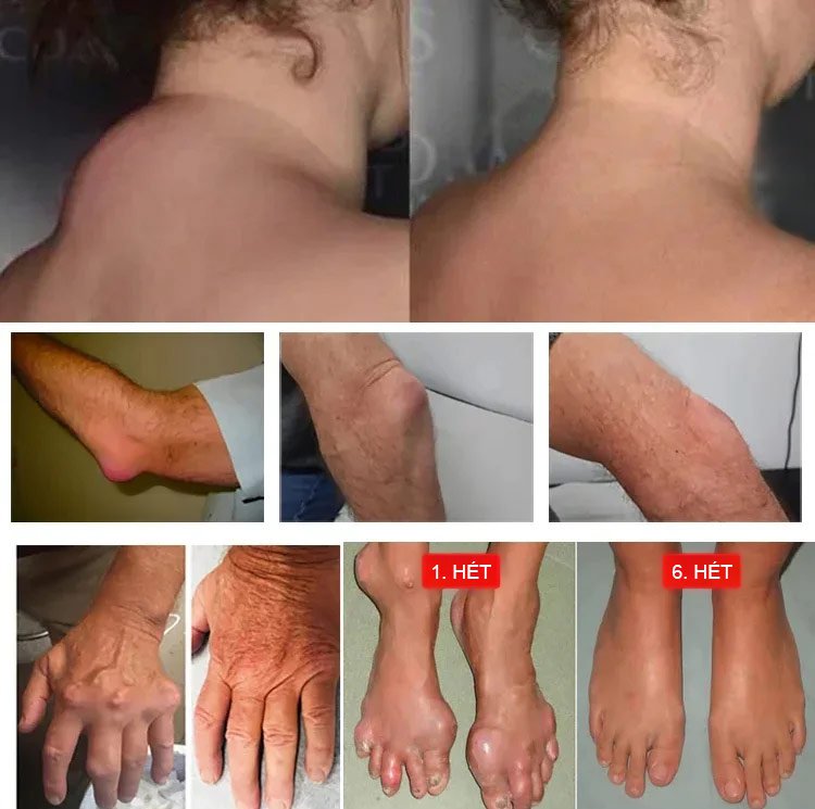 Izomlazító és fájdalomcsillapító Miaojiang ízületi balzsam