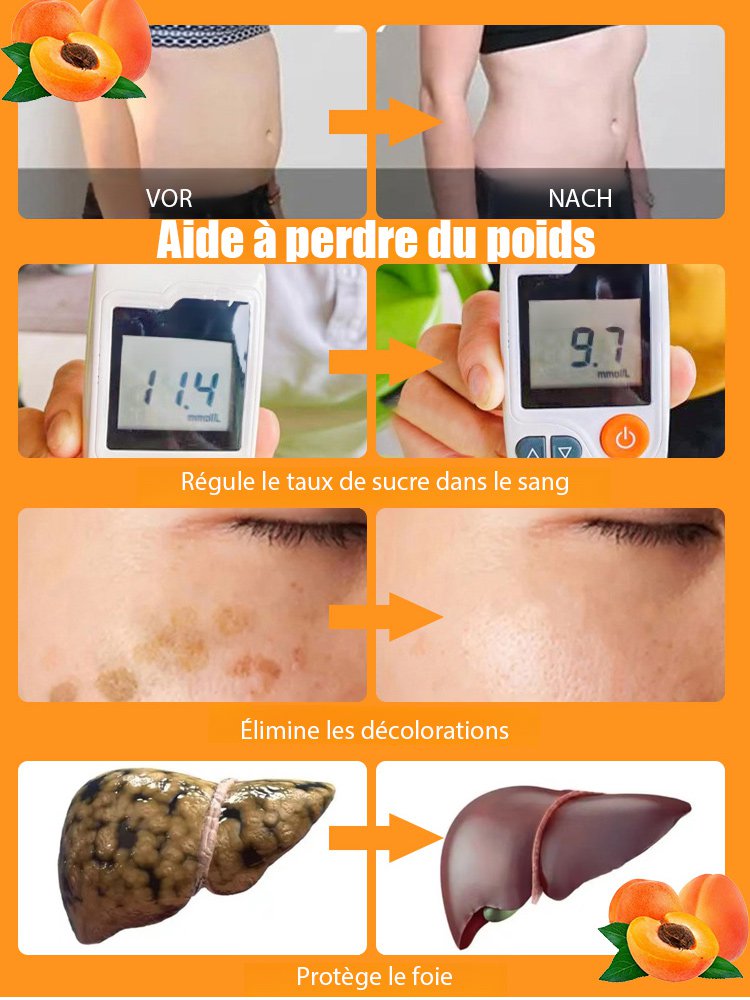 【Abricotier Impérial Géant】Plant de semis d'abricotier à haut rendement et facile à cultiver