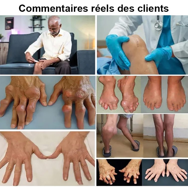Crème de réparation des articulations et des os