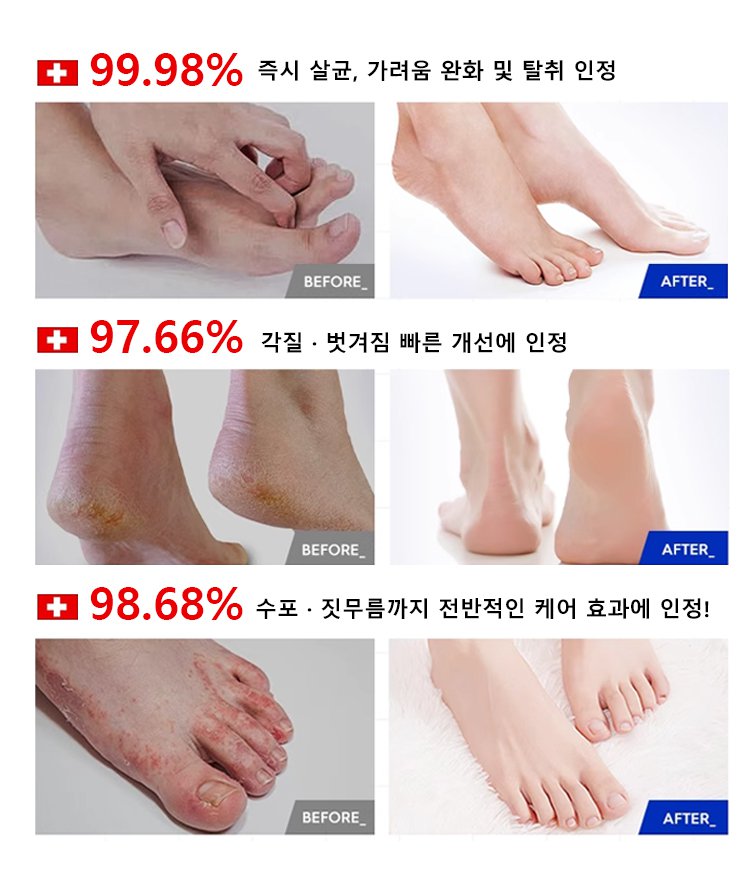 발 진균 관리 스프레이