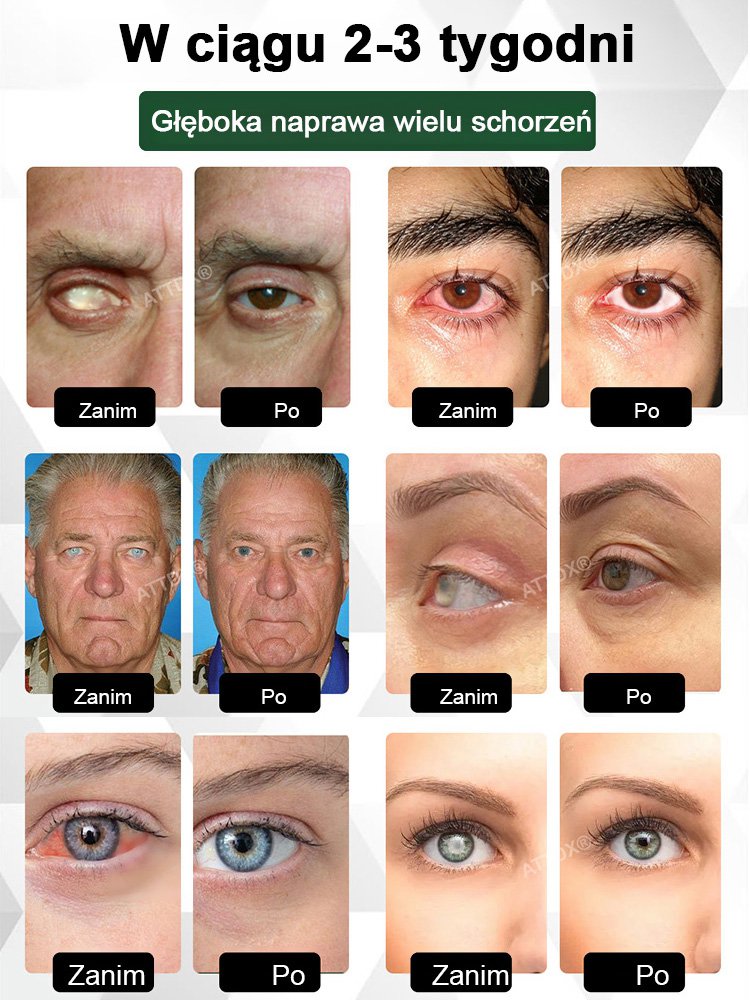 【Widzenie 5.0】krople do oczu przywracające wzrok