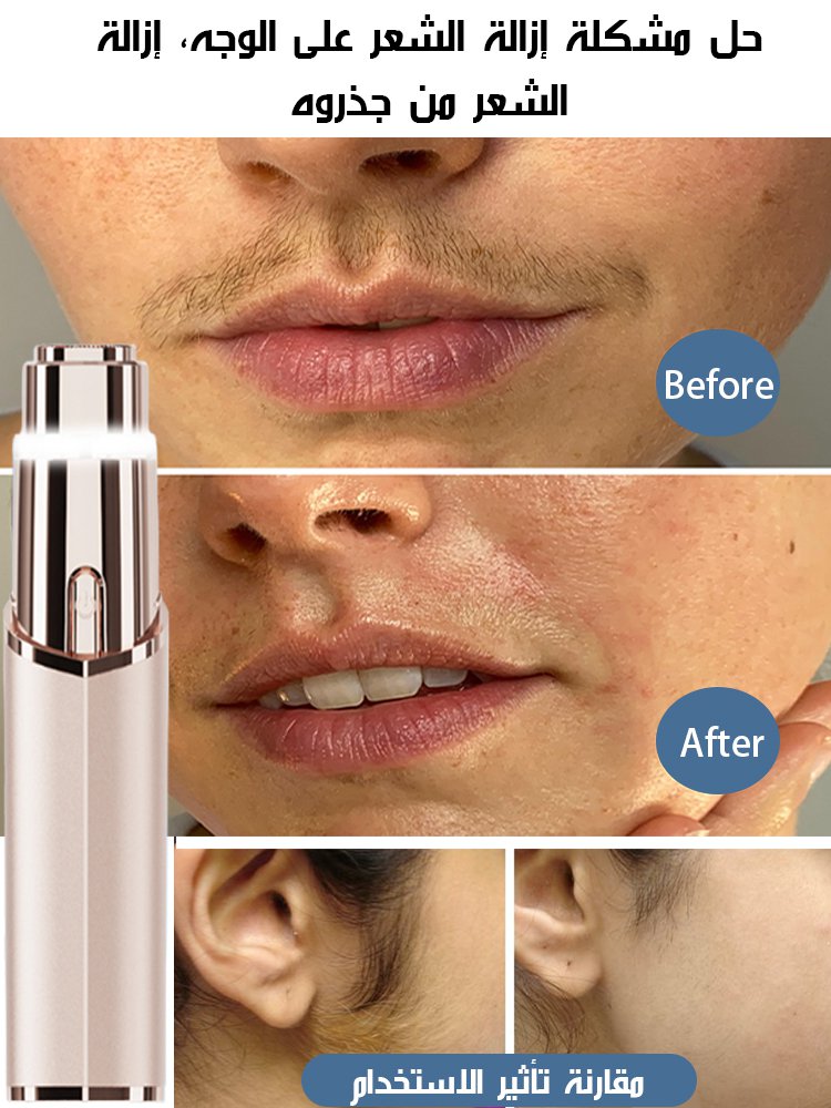 [عدم نمو الشعر لمدة ثلاثة أشهر]جهاز إزالة شعر الوجه الكهربائي العلمي