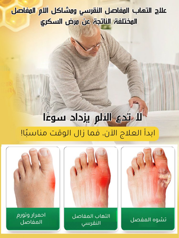 كريم العناية بالمفاصل بسم النحل