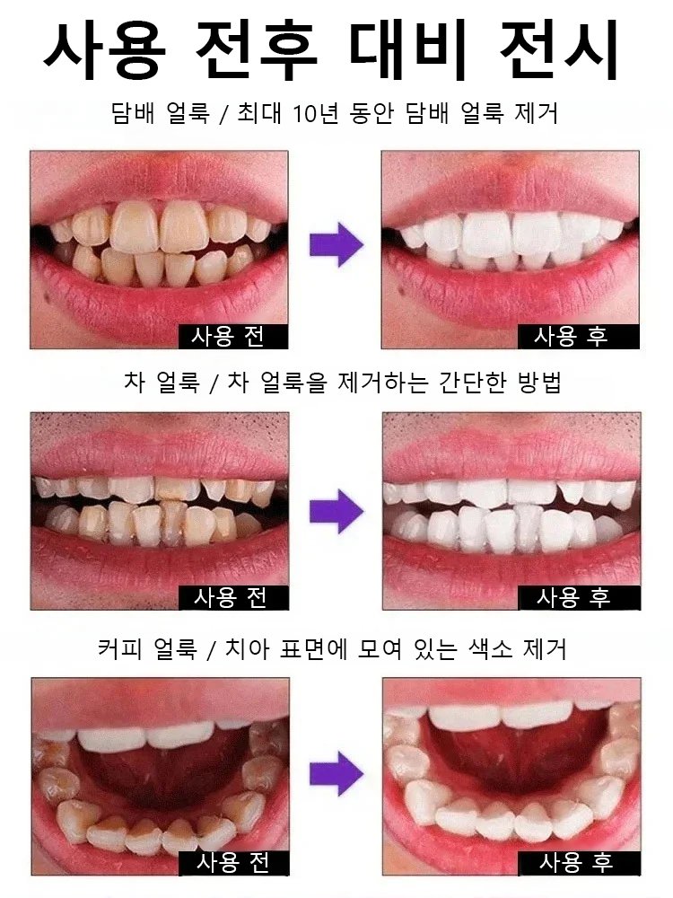 화이트닝 딥클렌징 퍼플 치아파우더