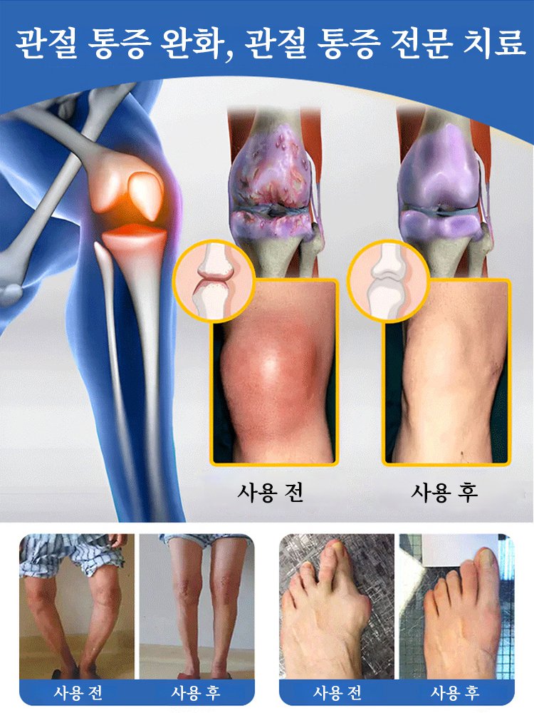 글루코사민 콘드로이틴 엘라스틱 냉찜질 패치