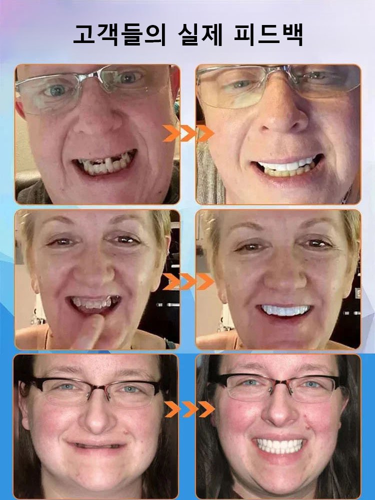 실리콘 모조 틀니