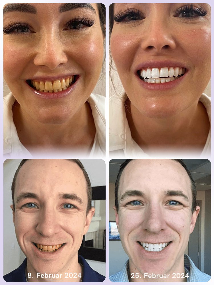 【Periodontal Health Restoration】Purple Mineral Tooth Powder for Tooth Restoration