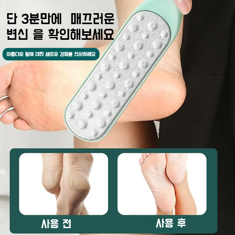 【죽은 피부 각질 한번에 제거】양면 스테인리스 발각질 제거기