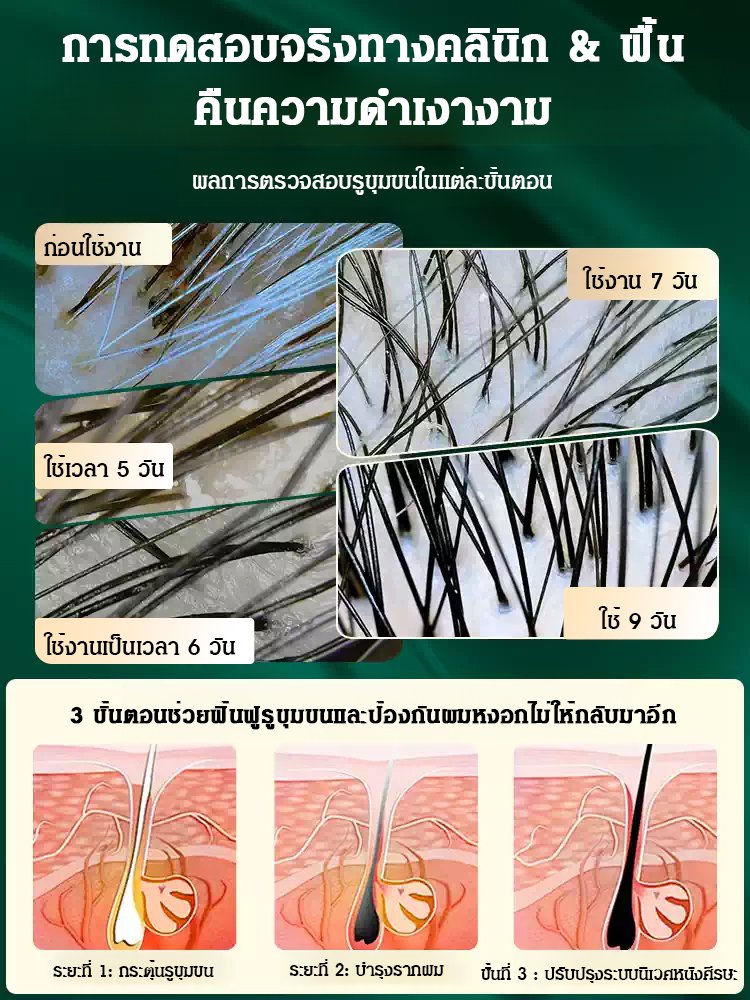 【ไวท์แฮร์ แคร์ แบล็ค】สเปรย์น้ำมันบำรุงผม
