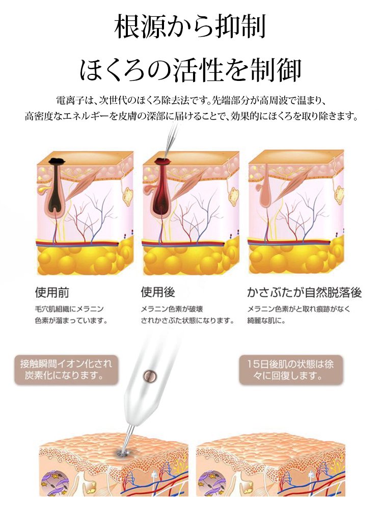 レーザーイボ取り美顔ペン