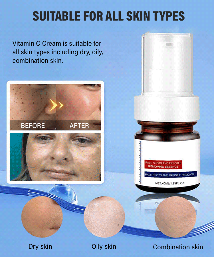 Freckle-Banishing Serum for Face: Repair and Cleanse Dark Spots