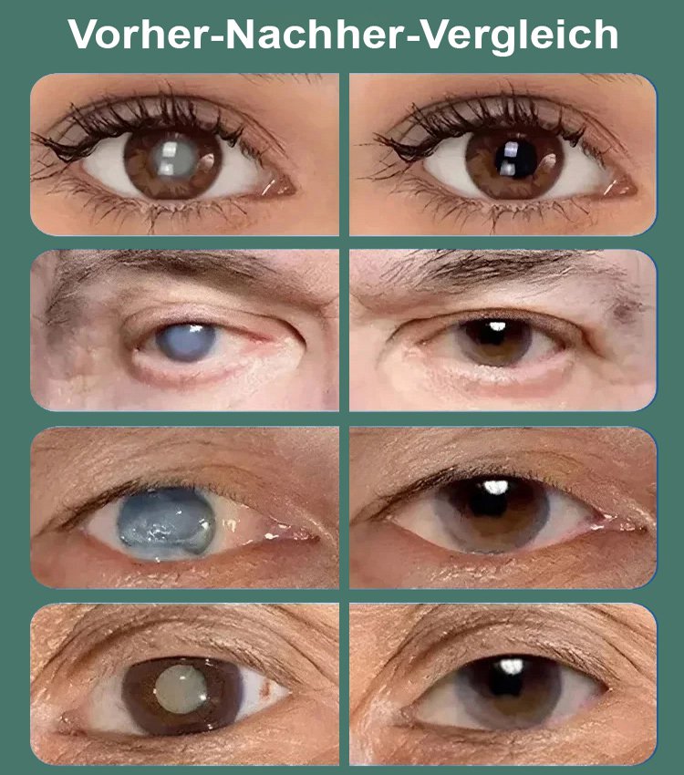 „Abschied von Grauem Star“ – für klare Sicht.